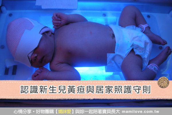 認識新生兒黃疸與居家照護守則