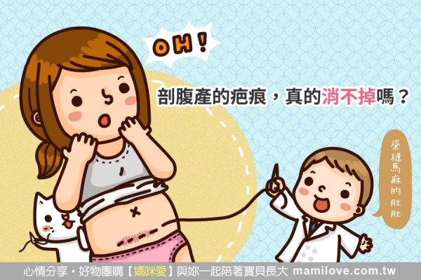 剖腹產的疤痕,真的消不掉嗎?