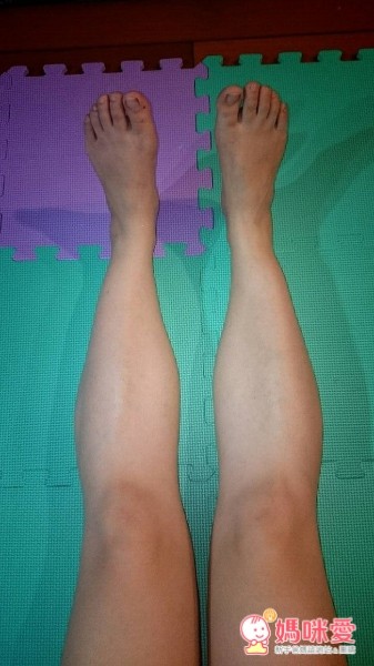 Zensah壓縮腿套, 小腿腿套, 孕婦腿套, 水腫腿套