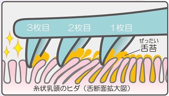 Leben 日本製舌苔清潔器