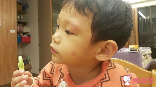 嬰幼兒專用AD天然草本木酢乳膏 30g