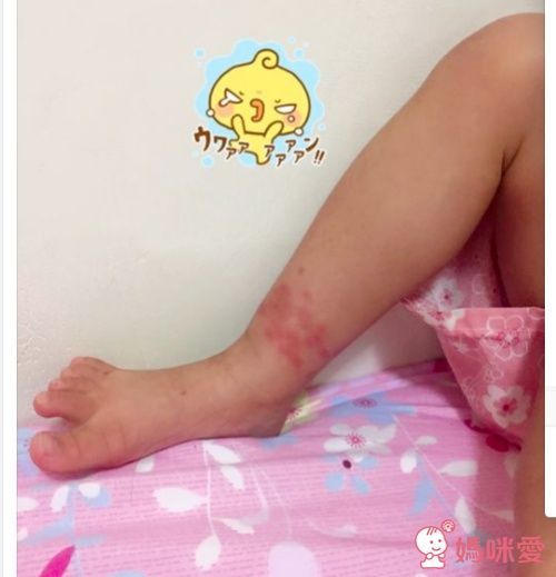 小黑蚊斑蚊專用防蚊液